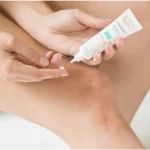 ژل ترمیم کننده سیکالیفت اسکار اون اورجینال