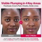 قبل و بعد کرم سرمی کلاژن ساز 2X Plumping نامبوزین