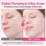 قبل و بعد سرم کلاژن ساز Plumping نامبوزین