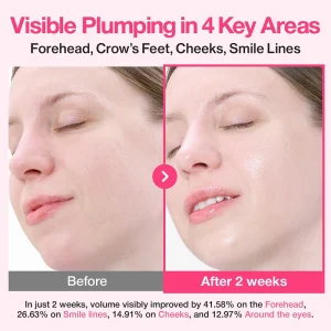قبل و بعد سرم کلاژن ساز Plumping نامبوزین