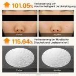 سرم لایه بردار دکتر ملاکسین پیل شات