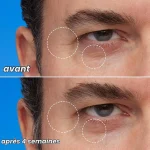 قبل و بعد روغن شب جوانساز پوست الف اصل